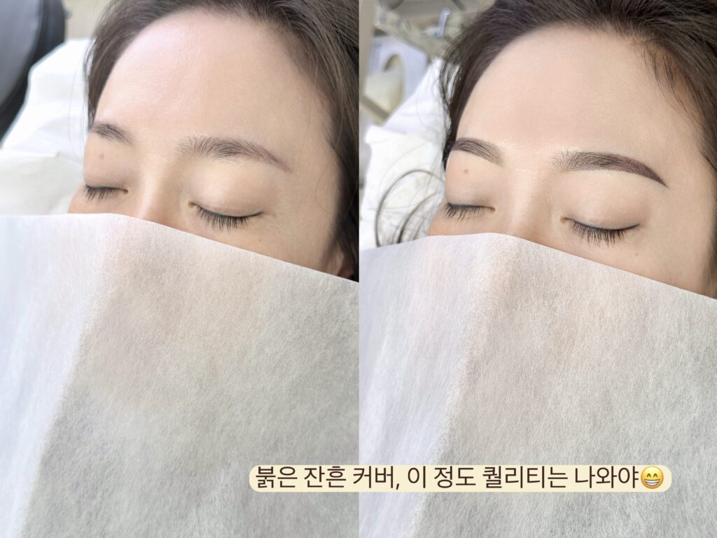 광주눈썹문신 붉은 잔흔 어라운드스튜디오 섀도우눈썹 비포애프터